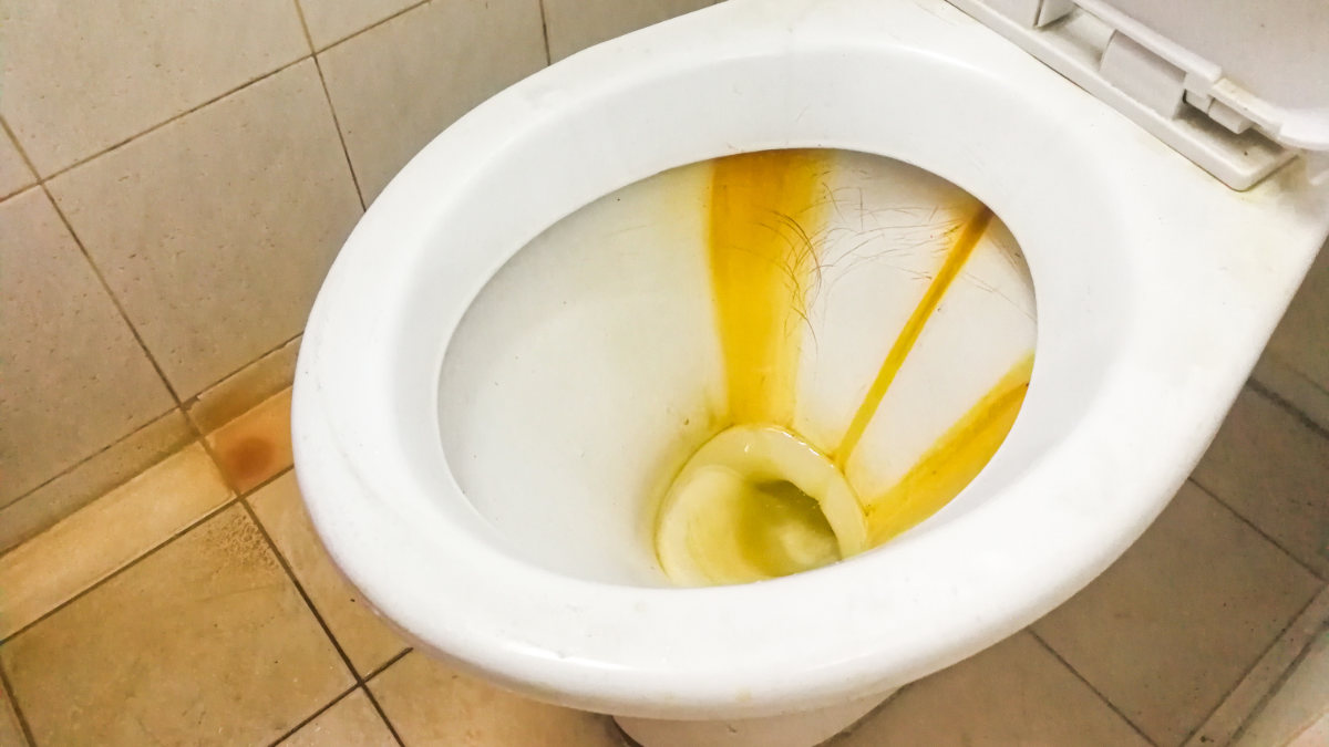 Step-by-step guide on how to remove stubborn yellow stains from your toilet